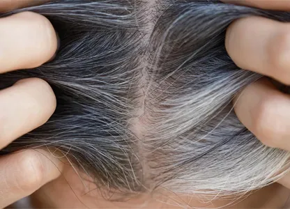 Yorgain Hair Care Experts Early-Greying-&-Brittleness